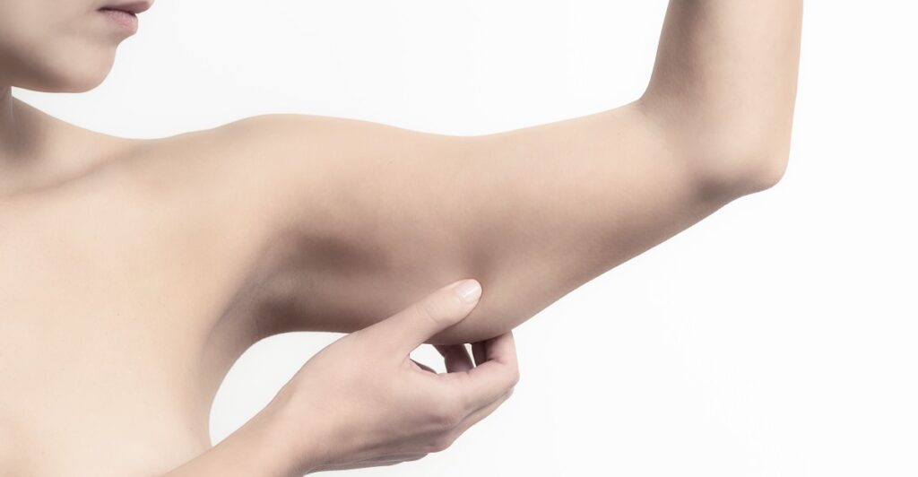 Can CoolSculpting Reduce Upper Arm Fat?